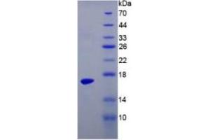 SDS-PAGE (SDS) image for Transthyretin (TTR) ELISA Kit (ABIN6574196)