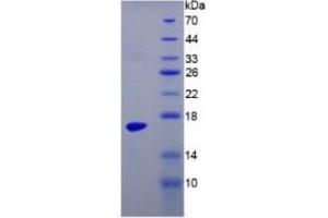 SDS-PAGE of Protein Standard from the Kit (Highly purified E. (TTR ELISA Kit)