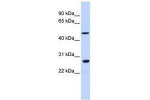 Image no. 1 for anti-Zinc Finger Protein 556 (ZNF556) (AA 36-85) antibody (ABIN6740460) (ZNF556 antibody  (AA 36-85))