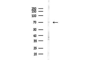 anti-Ubiquitin Protein Ligase E3C (UBE3C) antibody