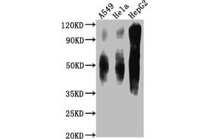 Western Blot Positive WB detected in: A549 whole cell lysate, Hela whole cell lysate, HepG2 whole cell lysate All lanes CD63 antibody at 1:1000 Secondary Goat polyclonal to mouse IgG at 1/50000 dilution Predicted band size: 30-120 KD KDa Observed band size: 30-120 KD KDa Exposure time:1 min (CD63 antibody  (AA 103-203))