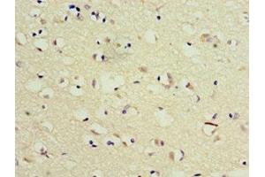 Immunohistochemistry of paraffin-embedded human brain tissue using ABIN7173541 at dilution of 1:100 (TSEN2 antibody  (AA 1-220))