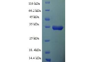 SDS-PAGE (SDS) image for Insulin-Like Growth Factor 1 Receptor (IGF1R) (AA 763-931), (partial) protein (GST tag) (ABIN5709725)