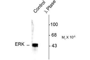Image no. 1 for anti-Mitogen-Activated Protein Kinase 3 (MAPK3) (pThr202), (Tyr204) antibody (ABIN372623) (ERK1 antibody  (pThr202, Tyr204))