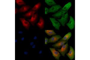 ABIN6260420 and ABIN6279238 staining  cells by IF/ICC. (Calreticulin 3 antibody  (C-Term))