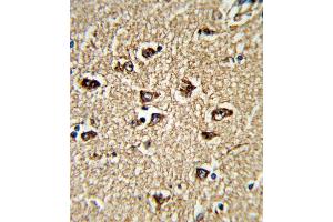 Formalin-fixed and paraffin-embedded human brain tissue reacted with BICC1 Antibody (N-term), which was peroxidase-conjugated to the secondary antibody, followed by DAB staining. (BICC1 antibody  (N-Term))