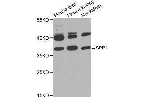 Western blot analysis of extracts of various cell lines, using SPP1 antibody (ABIN1874927) at 1:1000 dilution. (Osteopontin antibody)