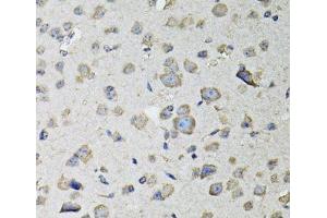 Immunohistochemistry of paraffin-embedded Mouse brain using RASSF1 Polyclonal Antibody at dilution of 1:100 (40x lens). (RASSF1 antibody)