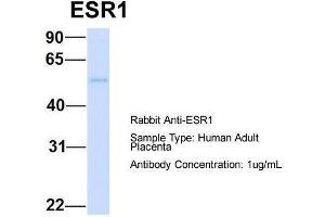 Host: Rabbit  Target Name: ESR1  Sample Tissue: Human Adult Placenta  Antibody Dilution: 1. (Estrogen Receptor alpha antibody  (C-Term))