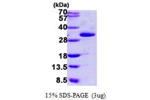 SDS-PAGE (SDS) image for Grancalcin, EF-Hand Calcium Binding Protein (GCA) (AA 1-217) protein (His tag) (ABIN7279305) (Grancalcin Protein (AA 1-217) (His tag))