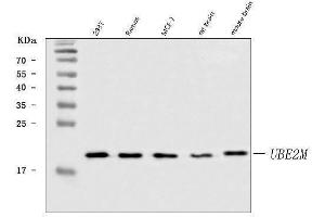 Western blot analysis of UBC12/UBE2M using anti-UBC12/UBE2M antibody (ABIN7600885).