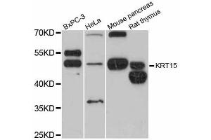 Western blot analysis of extracts of various cell lines, using KRT15 antibody (ABIN5998098) at 1:3000 dilution. (KRT15 antibody)