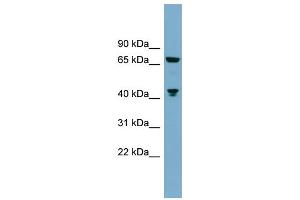 WB Suggested Anti-GLS  Antibody Titration: 0. (Glutaminase antibody  (C-Term))