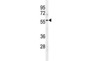 Western blot analysis of SPHK1 antibody and 293 lysate (SPHK1 antibody  (AA 313-343))