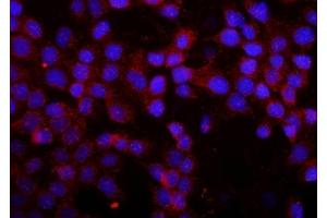 IF analysis of MMP16 using anti-MMP16 antibody (ABIN5519039).