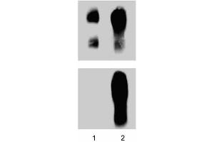 Human Endothelial cells were treated with#1 mM pervanadate for 15 min at 37°C. (CTNND1 antibody  (pTyr228))