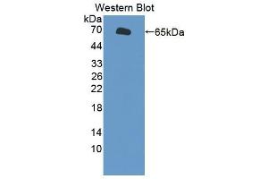 Western blot analysis of the recombinant protein. (SLC26A8 antibody  (AA 664-970))