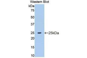 Western Blotting (WB) image for anti-Matrix Metallopeptidase 13 (Collagenase 3) (MMP13) (AA 103-290) antibody (ABIN1172282) (MMP13 antibody  (AA 103-290))
