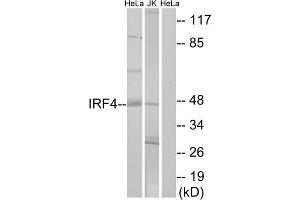 Western blot analysis of extracts from HeLa cells and Jurkat cells, using IRF4 antibody. (IRF4 antibody  (Internal Region))
