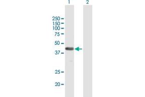 Western Blot analysis of FAM62B expression in transfected 293T cell line by FAM62B MaxPab polyclonal antibody. (FAM62B antibody  (AA 1-358))