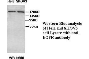 Image no. 1 for anti-Epidermal Growth Factor Receptor (EGFR) antibody (ABIN791216) (EGFR antibody)