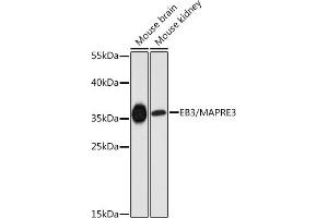 Western blot analysis of extracts of various cell lines, using EB3/EB3/M antibody (ABIN6130540, ABIN6143547, ABIN6143548 and ABIN6225046) at 1:3000 dilution. (MAPRE3 antibody  (AA 1-281))