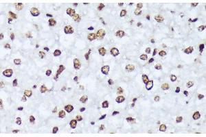 Immunohistochemistry of paraffin-embedded Mouse liver using Phospho-ABL1(Y245) Polyclonal Antibody at dilution of 1:100 (40x lens). (ABL1 antibody  (pTyr245))