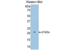 Western Blotting (WB) image for anti-Tumor Protein, Translationally-Controlled 1 (TPT1) (AA 1-172) antibody (ABIN1176579) (TPT1 antibody  (AA 1-172))
