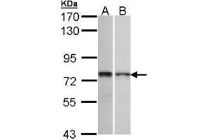 WB Image Sample (30 ug of whole cell lysate) A: 293T B: H1299 7. (ZNF398 antibody)