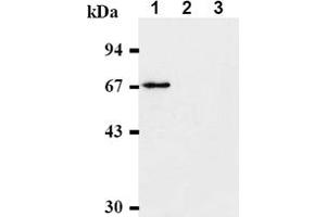 Western Blotting (WB) image for anti-Checkpoint Kinase 2 (CHEK2) antibody (ABIN487312) (CHEK2 antibody)