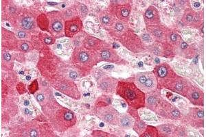 Human Liver (formalin-fixed, paraffin-embedded) stained with MYO5B antibody ABIN396915 at 20 ug/ml followed by biotinylated goat anti-rabbit IgG secondary antibody ABIN481713, alkaline phosphatase-streptavidin and chromogen. (MYO5B antibody  (C-Term))