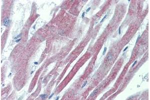Human Heart: Formalin-Fixed, Paraffin-Embedded (FFPE) (GALR2 antibody  (AA 212-277))