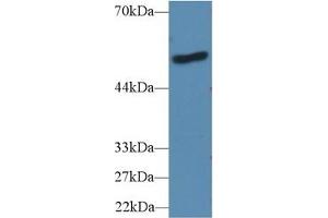 Detection of LBP in Human A431 cell lysate using Polyclonal Antibody to Lipopolysaccharide Binding Protein (LBP) (LBP antibody  (AA 25-481))