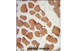 Formalin-fixed and paraffin-embedded human skeletal muscle reacted with PHYH2 Antibody (C-term), which was peroxidase-conjugated to the secondary antibody, followed by DAB staining. (HACL1 antibody  (C-Term))