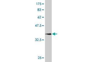 Western Blot detection against Immunogen (36. (CD56 antibody  (AA 611-710))