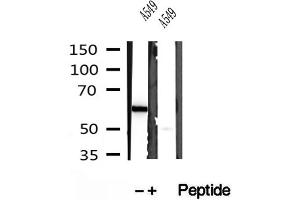 Western blot analysis of extracts of A549 cells, using PFKFB3-Specific antibody. (PFKFB3 antibody  (C-Term))