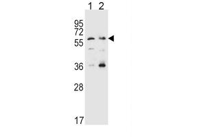 Western Blotting (WB) image for anti-Solute Carrier Family 22 Member 4 (SLC22A4) antibody (ABIN3002503)