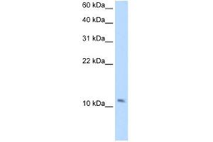 WB Suggested Anti-SMPX Antibody Titration:  2. (SMPX antibody  (Middle Region))