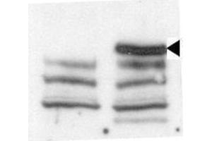 Western blot analysis of anti-JMJD3 C-term Pab (ABIN387863 and ABIN2844040) in untransfected 293 cells (left) and transfected 293 cells (right).