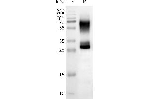Western Blotting (WB) image for Olfactory Receptor, Family 2, Subfamily B, Member 3 (OR2B3) protein (ABIN7538435)