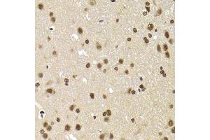 Immunohistochemistry of paraffin-embedded rat brain using SNRPA Antibody. (SNRPA1 antibody  (AA 1-282))