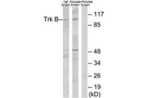 Western blot analysis of extracts from rat brain/mouse brain cells, treated with PBS 60', using Trk B (Ab-515) Antibody. (TRKB antibody  (AA 481-530))
