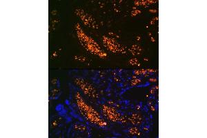 Immunofluorescence analysis of human placenta using HBG1 Rabbit mAb (ABIN1679149, ABIN1679148, ABIN7101336 and ABIN7101337) at dilution of 1:100 (40x lens). (HBG1/2 antibody)