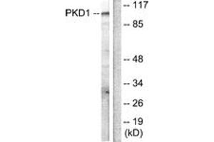 Western blot analysis of extracts from HuvEc cells, treated with PMA 125ng/ml 30', using PKD1/PKC mu (Ab-205) Antibody. (PKC mu antibody  (AA 171-220))
