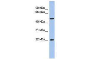 Image no. 1 for anti-Ankylosis, Progressive Homolog (Mouse) (ANKH) (AA 107-156) antibody (ABIN6743549) (ANKH antibody  (AA 107-156))