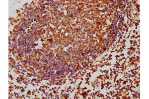 PPP2CB antibody  (Catalytic Subunit beta)