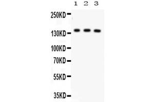 Western Blot of Anti-ABCB11 Antibody. (ABCB11 antibody  (C-Term))