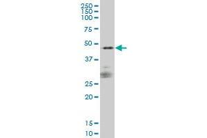 SIRPA monoclonal antibody (M01), clone 1D10 Western Blot analysis of SIRPA expression in IMR-32 .