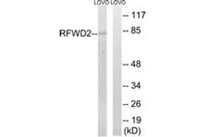 Western blot analysis of extracts from LOVO cells, using RFWD2 Antibody. (RFWD2 antibody  (AA 661-710))