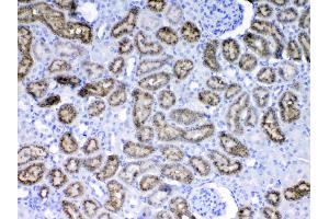 IHC analysis of RBP4 using anti-RBP4 antibody . (RBP4 antibody  (AA 19-201))